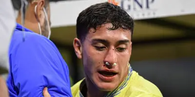 El atacante tendrá que ser intervenido tras el golpe que recibió en el América vs Rayados