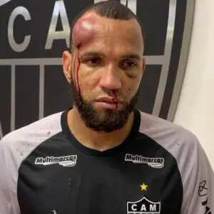 Así quedó Everson portero del Mineiro tras la campal