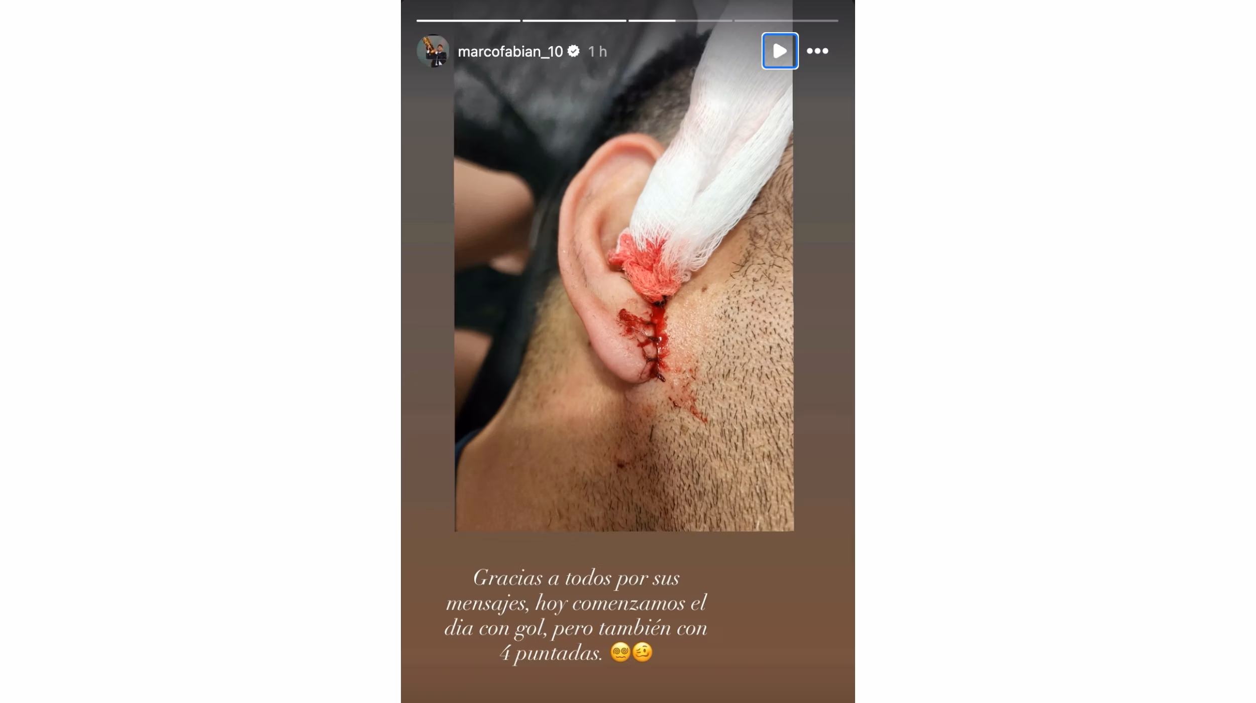 Marco Fabián exhibe las secuelas del golpe